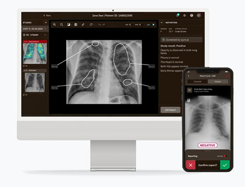 Teleradiology